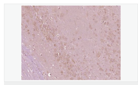 6059a9124cd44.png image.png